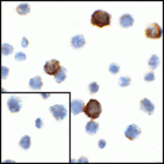 Immunocytochemistry of CD80 in transfected HEK293 cells with CD80 antibody at 1 μg/mL. Lower left: Immunocytochemistry in transfected HEK293 cells with control mouse IgG antibody at 1 μg/mL.