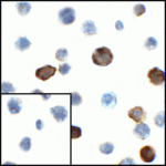 Immunocytochemistry of CD80 in transfected HEK293 cells with CD80 antibody at 1 μg/mL. Lower left: Immunocytochemistry in transfected HEK293 cells with control mouse IgG antibody at 1 μg/mL.