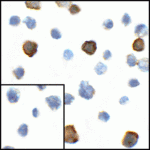 Immunocytochemistry of CD80 in transfected HEK293 cells with CD80 antibody at 1 μg/mL. Lower left: Immunocytochemistry in transfected HEK293 cells with control mouse IgG antibody at 1 μg/mL.