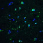 Immunofluorescence of CD81 in human brain tissue with CD81 antibody at 10 μg/ml.<br><br>Green: CD81 Antibody (5195) <br> Blue: DAPI staining