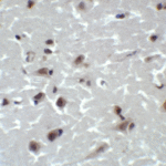 Immunohistochemistry of CD81 in human brain tissue with CD81 antibody at 2 μg/ml.