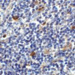 Immunohistochemistry of CD86 in human lymph node tissue with CD86 antibody at 2 μg/ml.