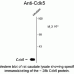 Western blot of rat caudate lysate showing specific immunolabeling of the ~28k Cdk5 protein.