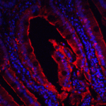 <strong>Figure 10 Immunohistochemistry Validation of CDKN2A in Human Colon Tissue </strong><br> Immunohistochemical analysis of paraffin-embedded Human Colon Tissue using anti- CDKN2A antibody (4211) at 10 μg/ml. Tissue was fixed with formaldehyde and blocked with 10% serum for 1 h at RT; antigen retrieval was by heat mediation with a citrate buffer (pH6). Samples were incubated with primary antibody overnight at 4°C. A goat anti-rabbit IgG H&L (HRP) at 1/250 was used as secondary. Counter stained with Hematoxylin.