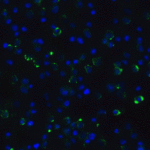 <strong>Figure 8 Immunofluorescence Validation of CDKN2A in Human A431 Cells</strong><br>Immunofluorescent analysis of 4% paraformaldehyde-fixed A431 cells labeling CDKN2A with 4211 at 20 μg/mL, followed by goat anti-rabbit IgG secondary antibody at 1/500 dilution (green) and DAPI staining (blue).
