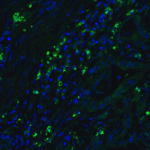 <strong>Figure 9 Immunofluorescence Validation of CDKN2A in Human Colon Tissue</strong><br>Immunofluorescent analysis of 4% paraformaldehyde-fixed human colon tissue labeling CDKN2A with 4211 at 20 μg/mL, followed by goat anti-rabbit IgG secondary antibody at 1/500 dilution (green) and DAPI staining (blue).