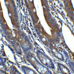 <strong>Figure 12 Immunohistochemistry Validation of CDKN2A in Rat Colon Tissue </strong><br> Immunohistochemical analysis of paraffin-embedded Rat Colon Tissue using anti- CDKN2A antibody (4211) at 5 μg/ml. Tissue was fixed with formaldehyde and blocked with 10% serum for 1 h at RT; antigen retrieval was by heat mediation with a citrate buffer (pH6). Samples were incubated with primary antibody overnight at 4°C. A goat anti-rabbit IgG H&L (HRP) at 1/250 was used as secondary. Counter stained with Hematoxylin.