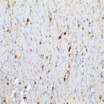 <strong>Figure 5 Immunohistochemistry Validation of CDKN2A in Human Colon Tissue</strong><br> Immunohistochemical analysis of paraffin-embedded human colon tissue using anti-CDKN2A antibody (8975) at 5 μg/ml. Tissue was fixed with formaldehyde and blocked with 10% serum for 1 h at RT; antigen retrieval was by heat mediation with a citrate buffer (pH6). Samples were incubated with primary antibody overnight at 4°C. A goat anti-rabbit IgG H&L (HRP) at 1/250 was used as secondary. Counter stained with Hematoxylin.