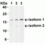 <strong>Figure 6 Western Blot Validation in Human Normal and Cancer Tissue</strong><br>Loading: 15 μg of lysates per lane.Antibodies CDKN2A 4211 (2 μg/mL), overnight incubation at 4°C in 5% NFDM/TBST.Secondary: Goat anti-rabbit IgG HRP conjugate at 1:10000 dilution.Lane 1: Human breastLane 2: Human lung tumorLane 3: Human colon cancer