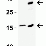 <strong>Figure 4 Recombinant Protein Test</strong><br>Loading: 15 μg of lysates per lane.Antibodies: CDKN2A 4211 (2 μg/mL), overnight incubation at 4°C in 5% NFDM/TBST.Secondary: Goat anti-rabbit IgG HRP conjugate at 1:10000 dilution.Lane 1: Human prostate (benign hyperplasia)Lane 2: Human CDKN2A recombinant protein (arrow: monomer and dimer)