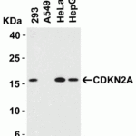 <strong>Figure 4 Western Blot Validation in Human Cell Lines</strong><br>Loading: 15 μg of lysates per lane.Antibodies: CDKN2A, 8975 (2 μg/mL), 1h incubation at RT in 5% NFDM/TBST.Secondary: Goat anti-rabbit IgG HRP conjugate at 1:10000 dilution.