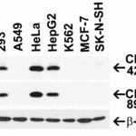 <strong>Figure 3 Independent Antibody Validation (IAV) via Protein Expression Profile in Cell Lines</strong><br>Loading: 15 μg of lysates per lane.Antibodies: CDKN2A 4211 (4 μg/mL), CDKN2A 24-023 (4 μg/mL), and beta-actin (1 μg/mL), overnight incubation at 4°C in 5% NFDM/TBST.Secondary: Goat anti-rabbit IgG HRP conjugate at 1:10000 dilution.
