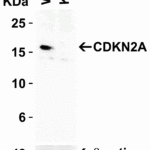 <strong>Figure 1 KO Validation of CDKN2A in 293 Cells</strong><br> Loading: 10 μg of 293 WT cell lysates or CDKN2A KO cell lysates. Antibodies: CDKN2A, 4211 (2 μg/mL) and beta-actin, 3779 (1 μg/mL), 1 h incubation at RT in 5% NFDM/TBST.Secondary: Goat Anti-Rabbit IgG HRP conjugate at 1:10000 dilution.