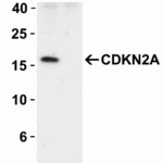<strong>Figure 1 KO Validation of CDKN2A in 293 Cells</strong><br> Loading: 10 μg of 293 WT cell lysates or CDKN2A KO cell lysates. Antibodies: CDKN2A, 8975 (2 μg/mL) and beta-actin, 3779 (1 μg/mL), 1 h incubation at RT in 5% NFDM/TBST.Secondary: Goat Anti-Rabbit IgG HRP conjugate at 1:10000 dilution.