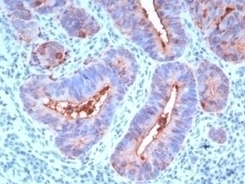 CEA Antibody [C66/195]