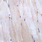 Immunohistochemistry of CHADL in mouse skeletal muscle tissue with CHADL antibody at 5 μg/mL.