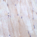 Immunohistochemistry of CHADL in mouse skeletal muscle tissue with CHADL antibody at 5 μg/mL.