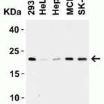 <strong>Figure 2 Western Blot Validation in Human Cell Lines</strong><br>Loading: 15 μg of lysates per lane.Antibodies: CLAUDIN4, 7025 (1 μg/mL), 1h incubation at RT in 5% NFDM/TBST.Secondary: Goat anti-rabbit IgG HRP conjugate at 1:10000 dilution.