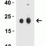 <strong>Figure 3 Western Blot Validation in Human Colon Tissue Lysate</strong><br>Loading: 15 μg of lysates per lane.Antibodies: CLAUDIN4, 7025 (Lane 1: 1 μg/mL and Lane 2: 2 μg/mL), 1h incubation at RT in 5% NFDM/TBST.Secondary: Goat anti-rabbit IgG HRP conjugate at 1:10000 dilution.