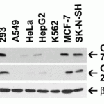 <strong>Figure 1 Independent Antibody Validation (IAV) via Protein Expression Profile in Human Cell Lines</strong><br>Loading: 15 μg of lysates per lane.Antibodies: CLAUDIN4, 7025 (1 μg/mL), CLAUDIN4, 24-028 (1 μg/mL), and beta-actin (1 μg/mL),  1h incubation at RT  in 5% NFDM/TBST.Secondary: Goat anti-rabbit IgG HRP conjugate at 1:10000 dilution.