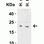<strong>Figure 3 Western Blot Validation in Human Tissue Lysates</strong><br>Loading: 15 μg of lysates per lane.Antibodies: CLDN1, 5187 (1 μg/mL) , 1h incubation at RT in 5% NFDM/TBST.Secondary: Goat anti-rabbit IgG HRP conjugate at 1:10000 dilution.