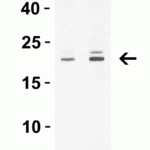 <strong>Figure 3 Western Blot Validation in Human Tissue Lysates</strong><br>Loading: 15 μg of lysates per lane.Antibodies: CLDN1, 5187 (1 μg/mL) , 1h incubation at RT in 5% NFDM/TBST.Secondary: Goat anti-rabbit IgG HRP conjugate at 1:10000 dilution.