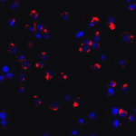 Immunofluorescence of CLEC7A in Jurkat cells with CLEC7A antibody at 20 μg/mL.
