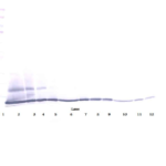 To detect Human CTACK by Western Blot analysis this antibody can be used at a concentration of 0.1 - 0.2 ug/ml. When used in conjunction with compatible secondary reagents the detection limit for recombinant Human CTACK is 1.5 - 3.0 ng/lane, under either reducing or non-reducing conditions.
