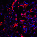 Immunofluorescence of CTLA-4 in human lymph node tissue with CTLA-4 antibody at 20 μg/mL. <br><br>Red: CTLA4 Antibody [1E6] (RF16011) <br> Blue: DAPI staining