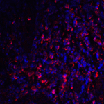 Immunofluorescence of CTLA-4 in human tonsil tissue with CTLA-4 antibody at 20 μg/mL. <br><br>Red: CTLA4 Antibody [1E6] (RF16011) <br> Blue: DAPI staining