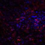 Immunofluorescence of CTLA-4 in human lymph node tissue with CTLA-4 antibody at 20 μg/mL. <br><br>Red: CTLA4 Antibody [2G10] (RF16012) <br> Blue: DAPI staining
