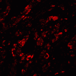 Immunofluorescence of CTLA-4 in human lymph node tissue with CTLA-4 antibody at 20 μg/mL.