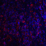 Immunofluorescence of CTLA-4 in human tonsil tissue with CTLA-4 antibody at 20 μg/mL. <br><br>Red: CTLA4 Antibody [8A1] (RF16013) <br> Blue: DAPI staining
