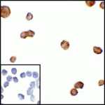 Immunocytochemistry of CTLA-4 in transfected HEK293 cells with CTLA-4 antibody at 5 μg/mL. Lower left: Immunocytochemistry in transfected HEK293 cells with control mouse IgG antibody at 5 μg/mL.
