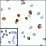 Immunocytochemistry of CTLA-4 in transfected HEK293 cells with CTLA-4 antibody at 5 μg/mL. Lower left: Immunocytochemistry in transfected HEK293 cells with control mouse IgG antibody at 5 μg/mL.