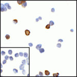 Immunocytochemistry of CTLA-4 in transfected HEK293 cells with CTLA-4 antibody at 5 μg/mL. Lower left: Immunocytochemistry in transfected HEK293 cells with control mouse IgG antibody at 5 μg/mL.