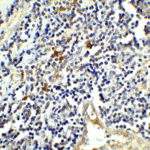 Immunohistochemistry of CTLA-4 in human tonsil tissue with CTLA-4 antibody at 5 μg/mL.