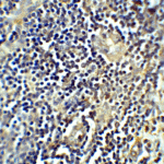 Immunohistochemistry of CTLA-4 in human tonsil tissue with CTLA-4 antibody at 5 μg/mL.