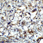 Immunohistochemistry of CTLA-4 in human lymph node tissue with CTLA-4 antibody at 5 μg/mL.
