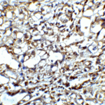 Immunohistochemistry of CTLA-4 in human lymph node tissue with CTLA-4 antibody at 5 μg/mL.