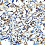 Immunohistochemistry of CTLA-4 in human lymph node tissue with CTLA-4 antibody at 5 μg/mL.
