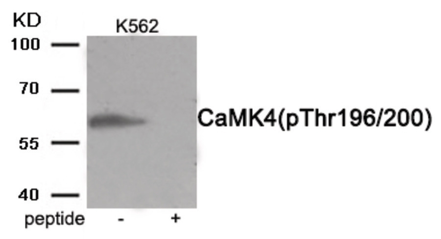 CaMK4 (phospho Thr196/200) Antibody