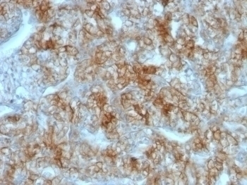 Cadherin 16 Antibody [CDH16/1071]
