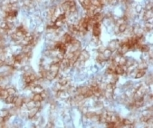 Cadherin 16 Antibody [KSCP2]