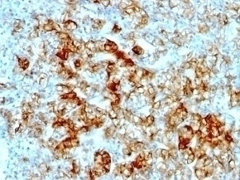 Cadherin 16 Antibody [SPM594]