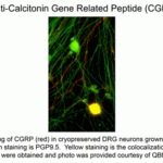 Immunostaining of CGRP (red) in cryopreserved DRG neurons grown on coverslips. 40xmag.  Green staining is PGP9.5.  Yellow staining is the colocalization of CGRP and PGP9.5.  Cells were obtains and photo was provided courtesy of QBM Cell Science.