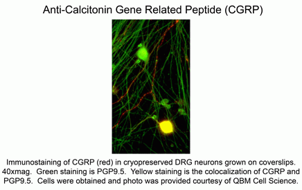 Calcitonin Gene Related Peptide (CGRP) Antibody [4901]