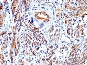 Caldesmon / CAD Antibody