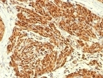 Calponin Antibody [CALP]