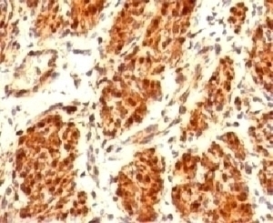 Calponin Antibody [CLPN5-1]